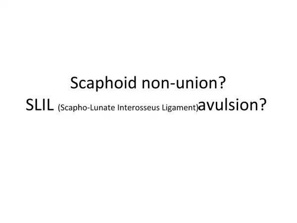 Scaphoid non-union SLIL Scapho-Lunate Interosseus Ligament avulsion