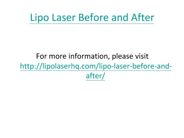 Lipo Laser Before and After