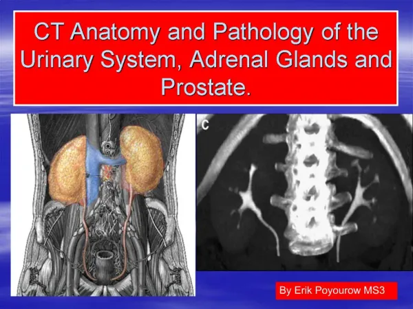 CT Anatomy and Pathology of the Urinary System, Adrenal Glands and Prostate.