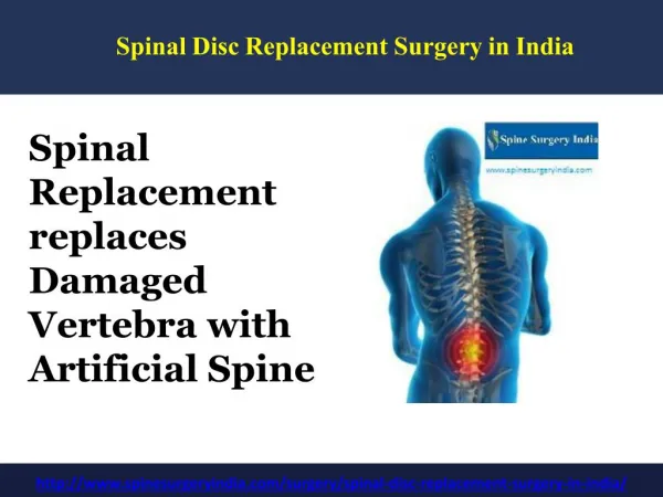 Spinal Disc Replacement Surgery in India