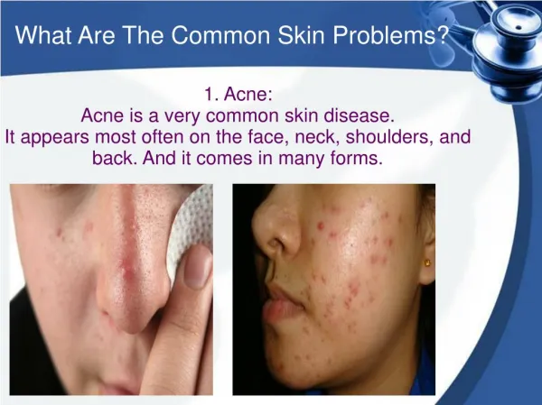 What Are The Common Skin Problems?