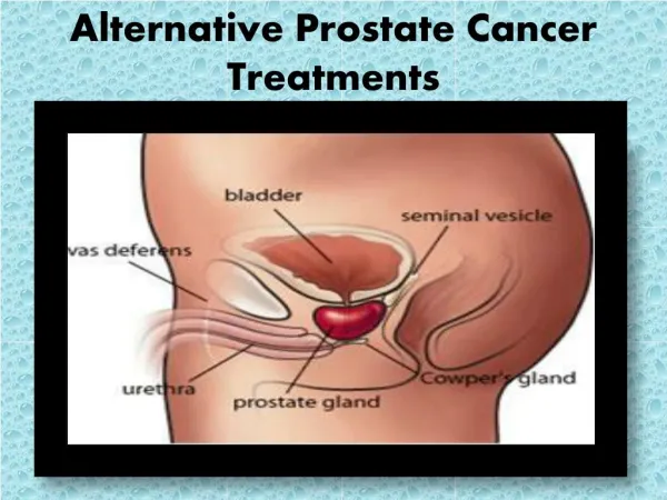 Alternative Prostate Cancer Treatments
