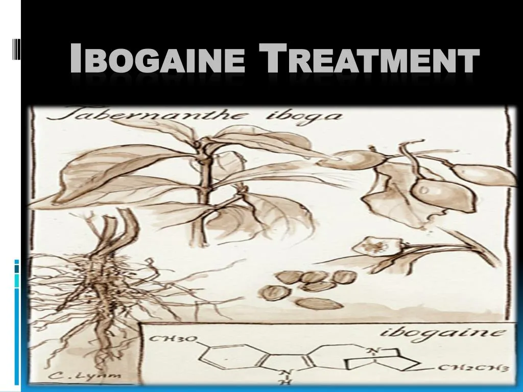 ibogaine treatment