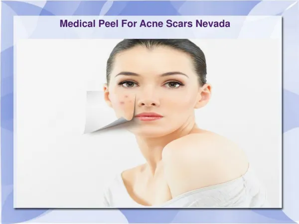 Medical Peel For Acne Scars Nevada