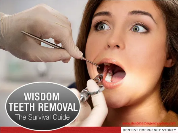 Wisdom Teeth Removal - The Survival Guide