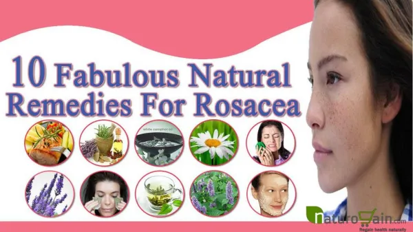 10 Fabulous And Easy Natural Remedies For Rosacea