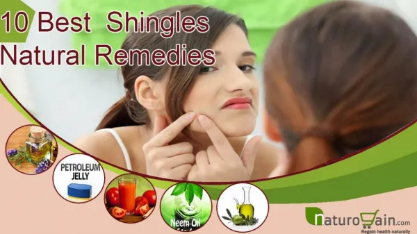 Best Known Shingles Natural Remedies For Quick Relief