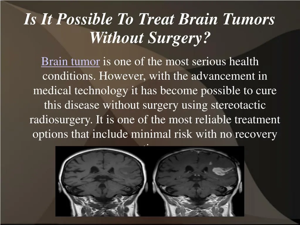 is it possible to treat brain tumors without surgery