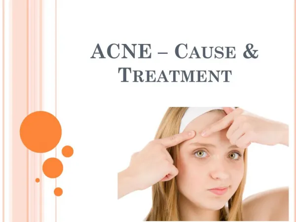 Acne - Cause and Treatment