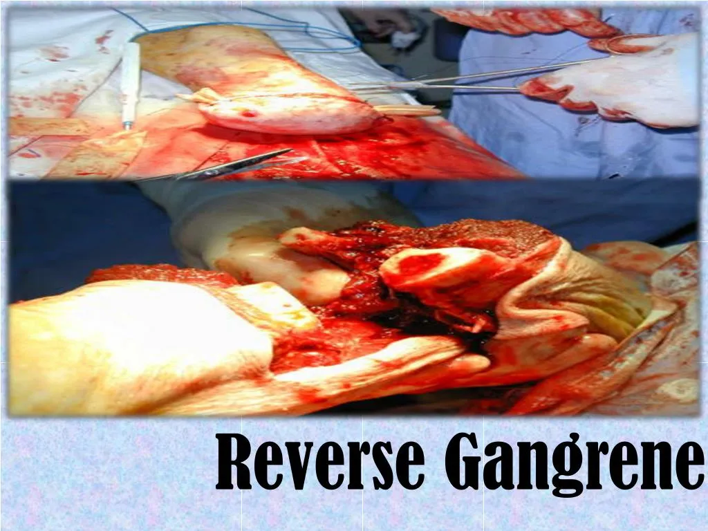 reverse gangrene