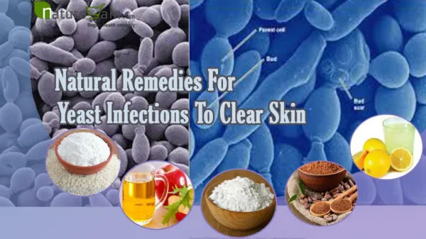Natural Remedies For Yeast Infections To Clear Infections