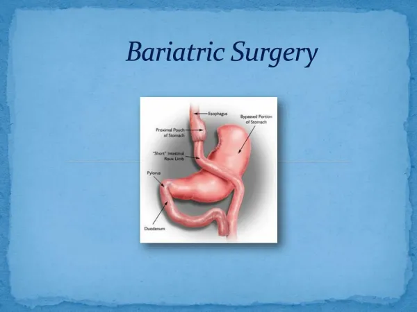 Doss India - Bariatric Surgeon, Bariatric Surgery Treatment