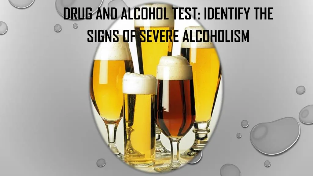 drug and alcohol test identify the signs of severe alcoholism