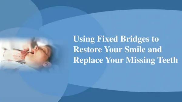 Using Fixed Bridges to Restore Your Smile