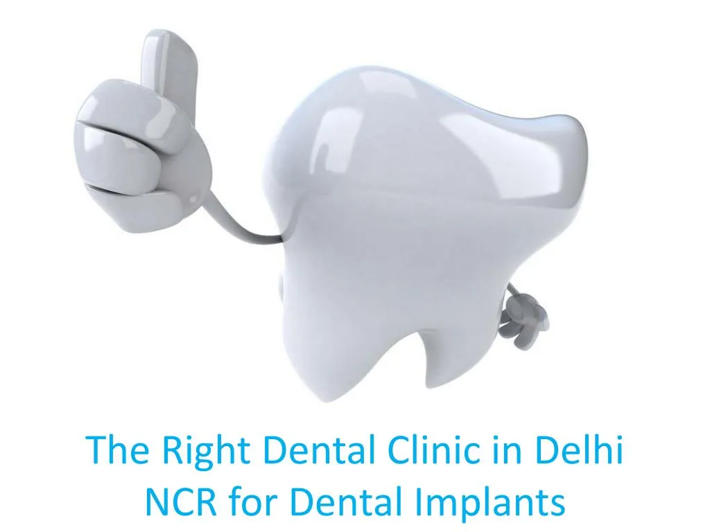 the right dental clinic in delhi ncr for dental implants