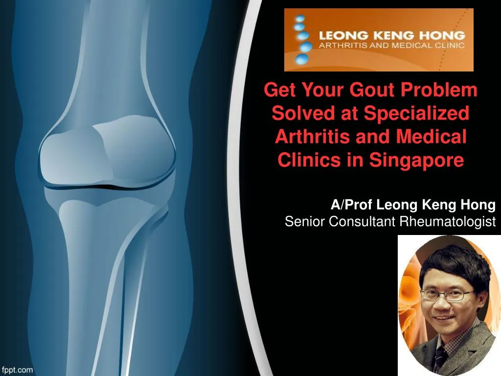 get your gout problem solved at specialized arthritis and medical clinics in singapore