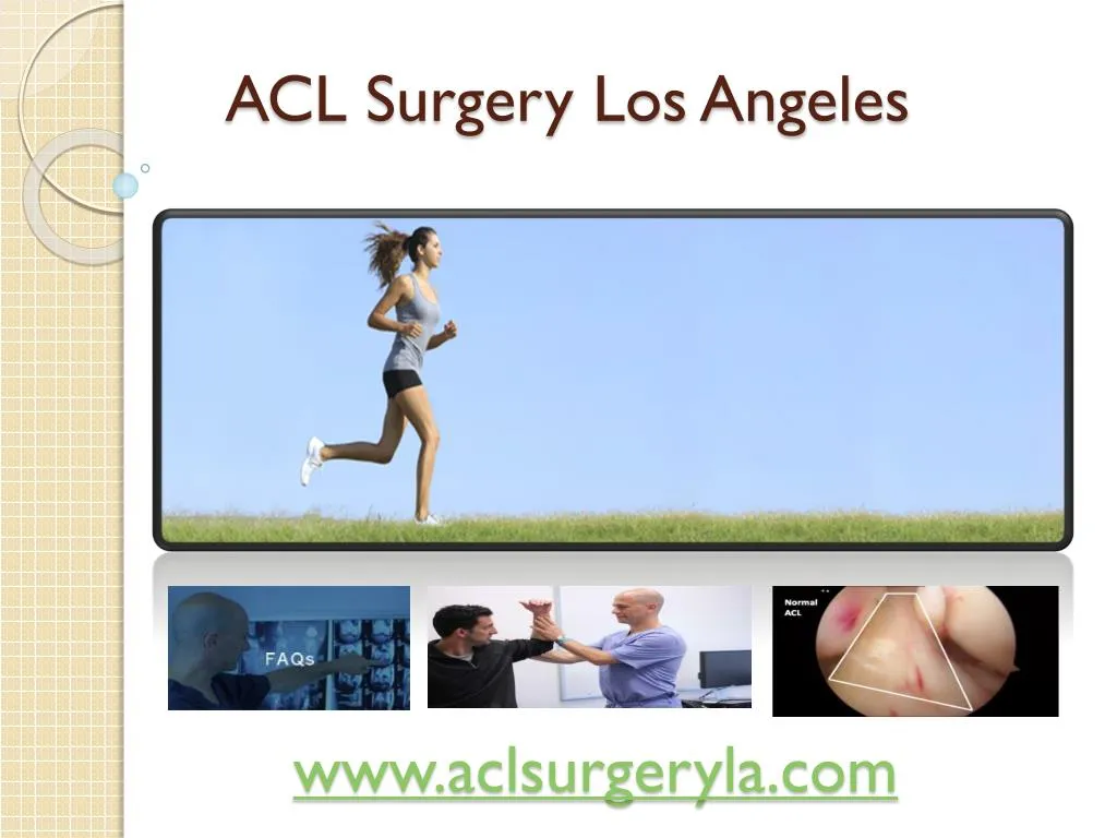 acl surgery los angeles