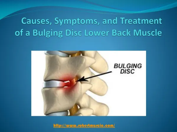 Causes, Symptoms, and Treatment of a Bulging Disc Lower Back