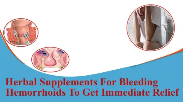 Herbal Supplements For Bleeding Hemorrhoids To Get Immediate