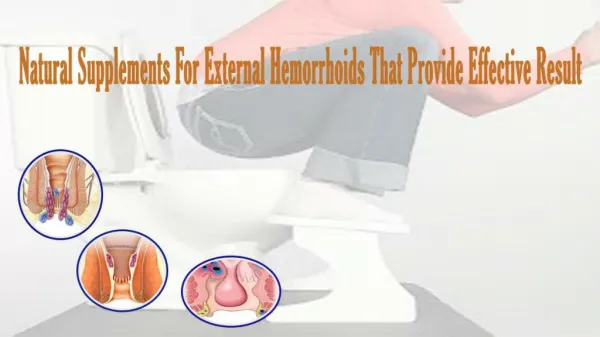 Natural Supplements For External Hemorrhoids That Provide