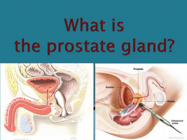 What is the prostate gland?