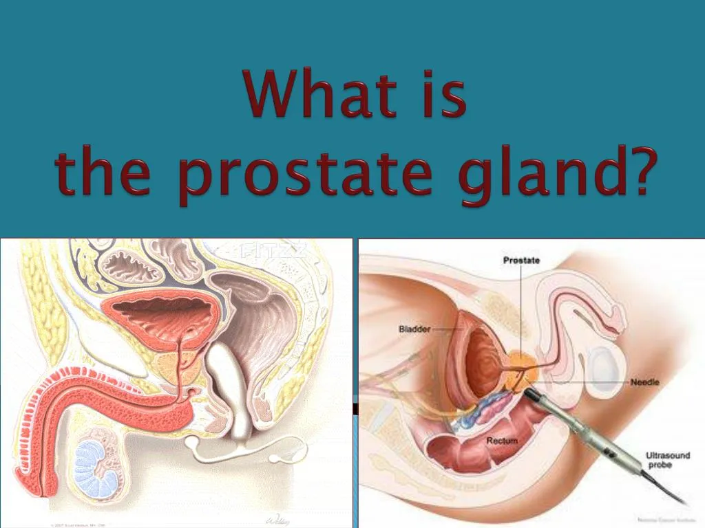 what is the prostate gland