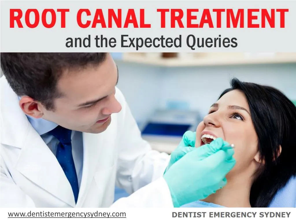 root canal treatment and the expected queries