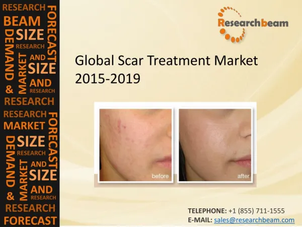 Global Scar Treatment Market Size, Trends, Technology