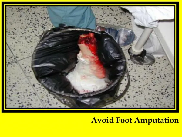 Avoid Foot Amputation