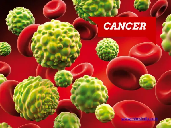 Cancer Treatment in Kerala