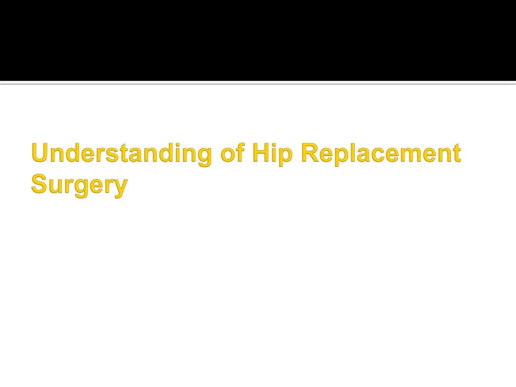 understanding of hip replacement surgery