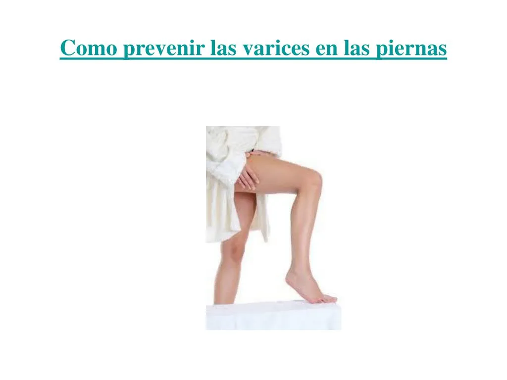 como prevenir las varices en las piernas