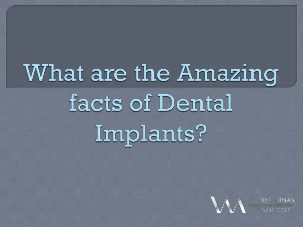 What are the Amazing facts of Dental Implants?