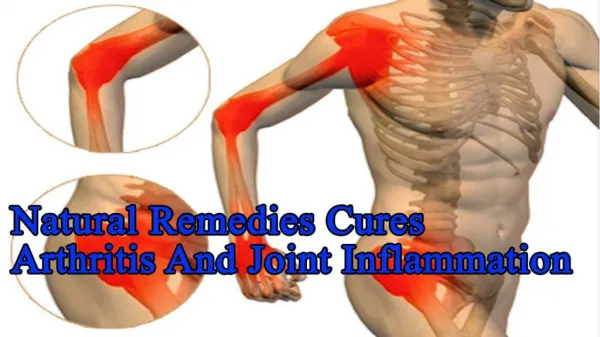Natural remedies Cures Arthritis And Joint Inflammation