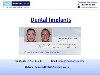 Dental implants - slide 1