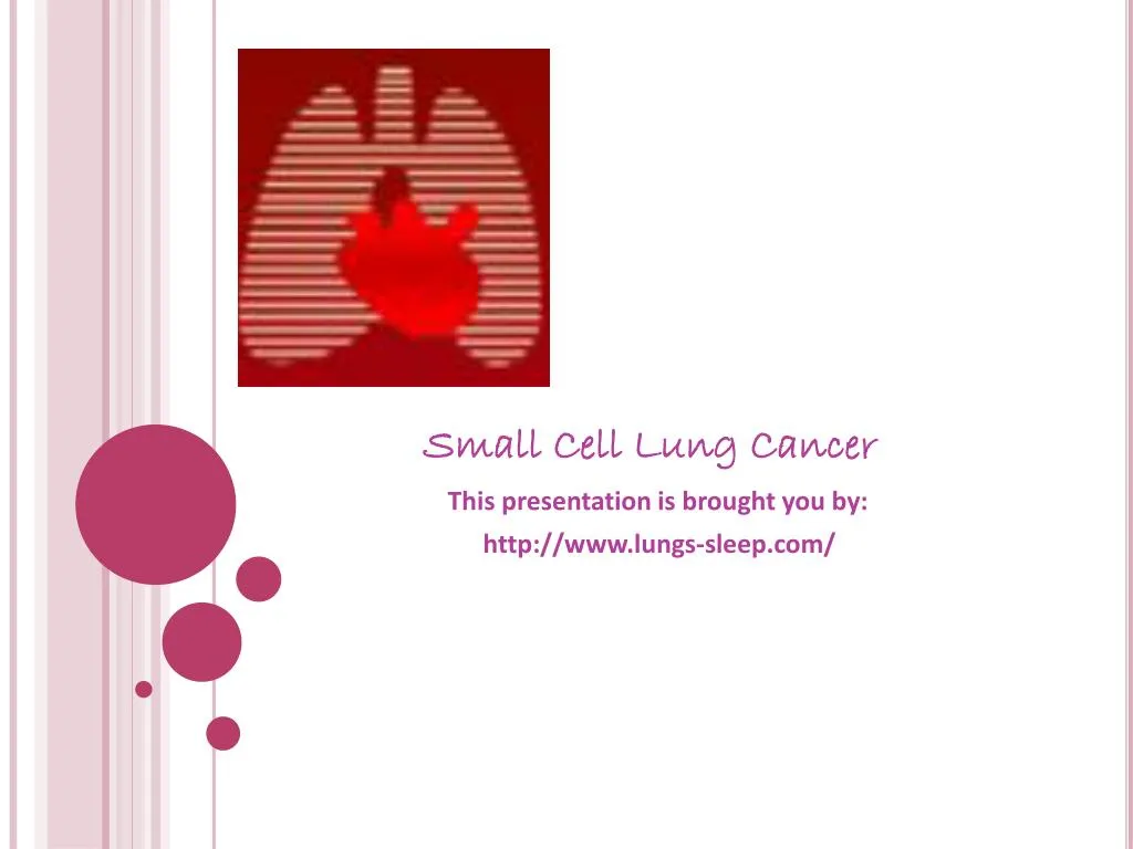 small cell lung cancer this presentation is brought you by http www lungs sleep com
