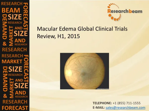 Macular Edema Global Clinical Trials Review, H1, 2015