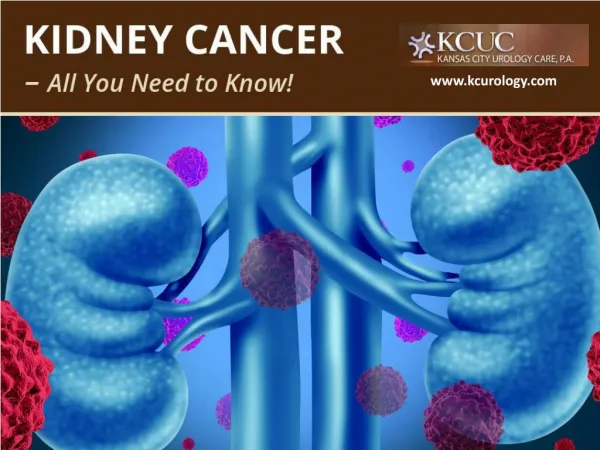 Cancer of the Kidney - What You Need to Know!
