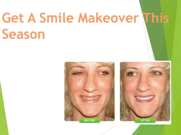 Get A Smile Makeover This Season