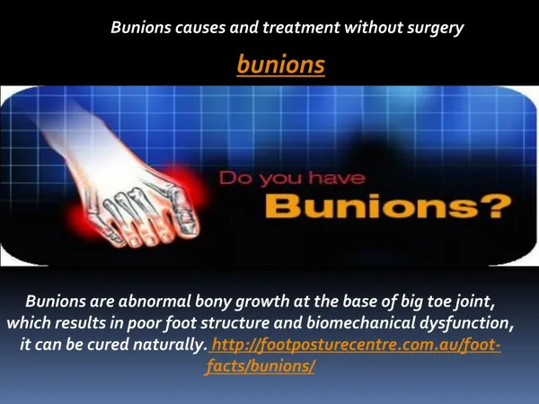Bunions causes and treatment without surgery