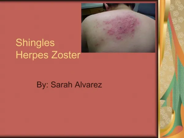 Shingles Herpes Zoster