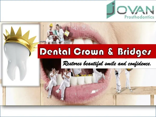 Dental Crown & Bridges Restores Beautiful Smile & Confidence