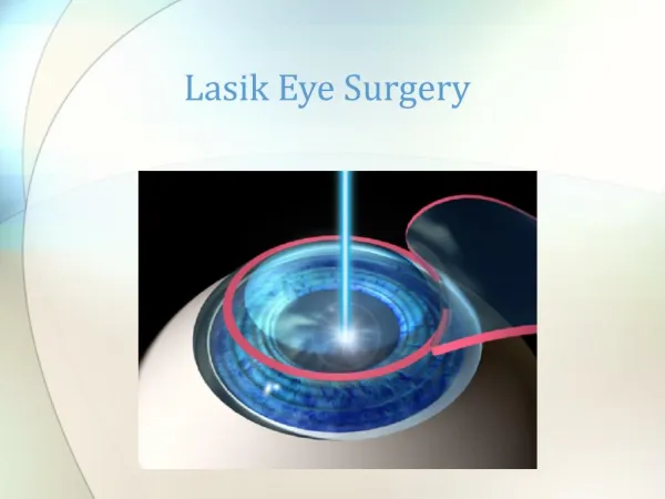 Lasik Eye Surgery in Bangalore