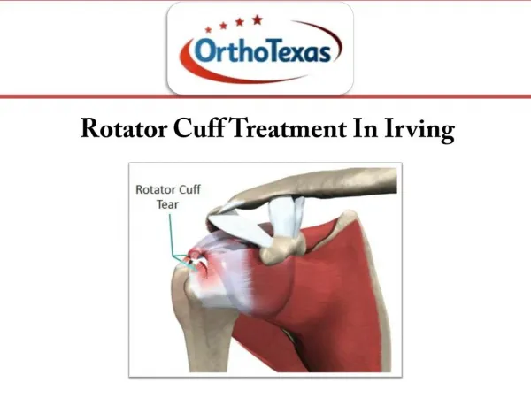 Rotator Cuff Treatment In Irving