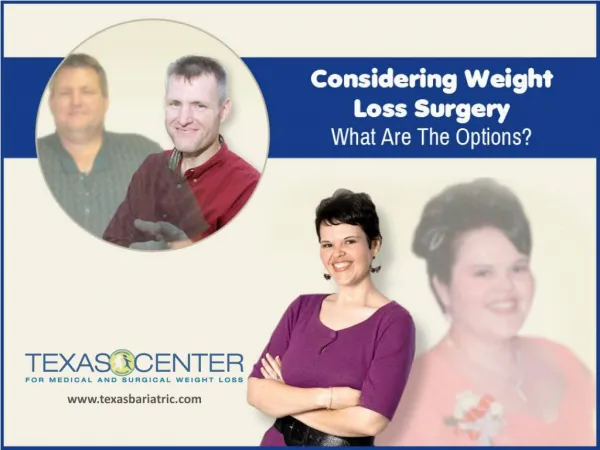 Weight Loss Surgery in San Antonio – Things to Know!