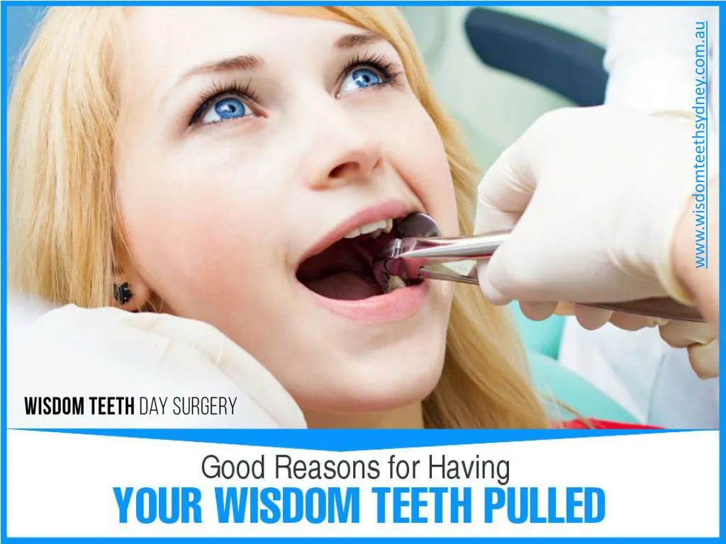 good reasons for having your wisdom teeth pulled