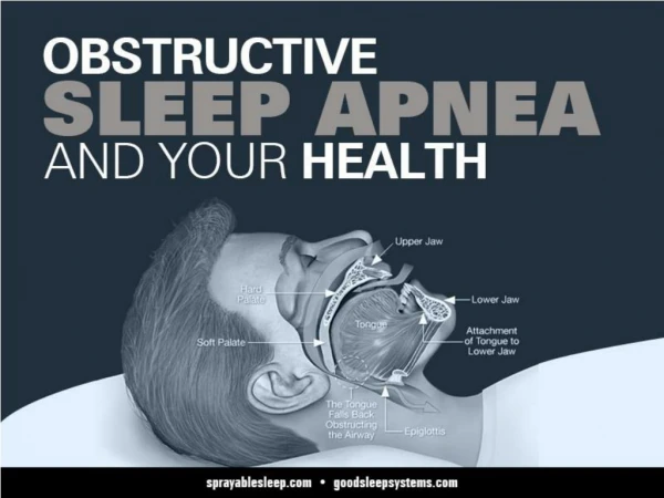 PPT - The Best Obstructive Sleep Apnea Course to Grow Your Business ...