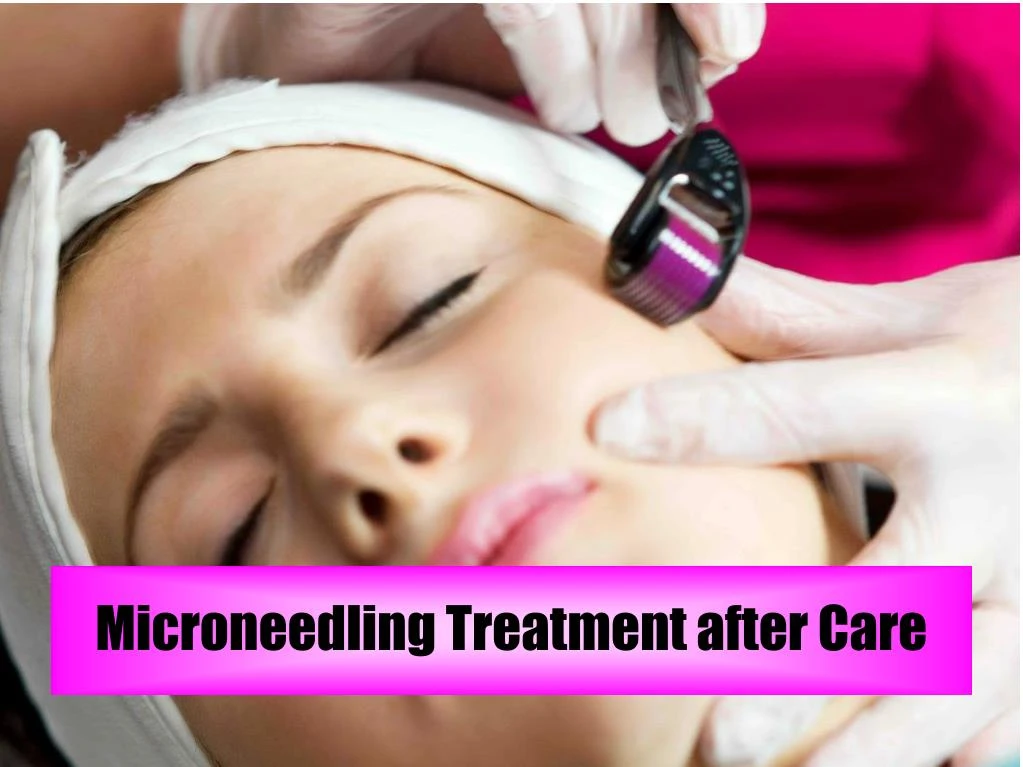 microneedling treatment after care