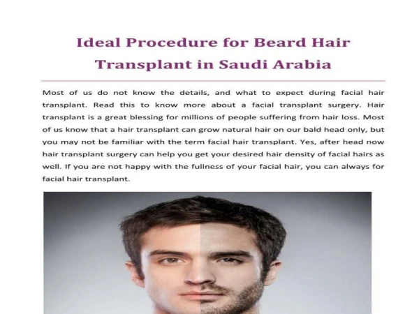 Beard Hair Transplant Saudi Arabia