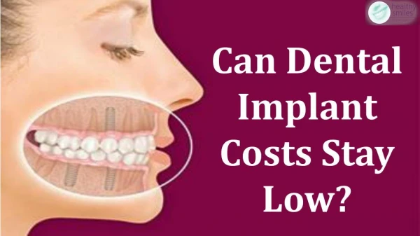 Can Dental Implant Costs Stay Low?